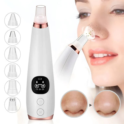 Blackhead Remover